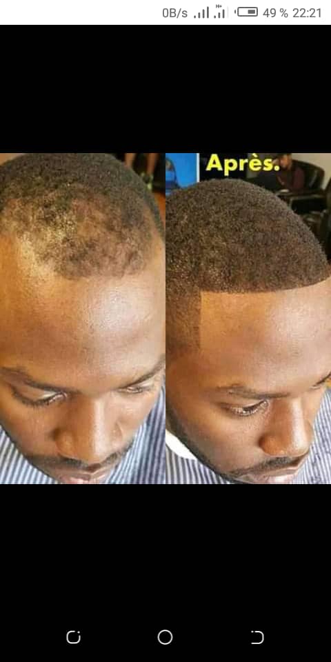 Avant apres